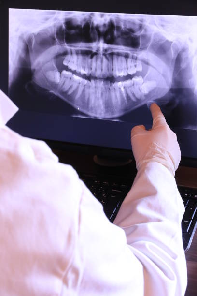 Best Emergency Dentist for Knocked-Out Tooth in Ferdand, IN