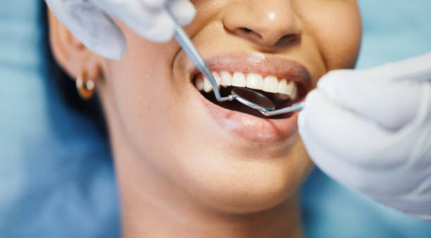 Best Emergency Dentist for Lost Fillings or Crowns in Ferdand, IN