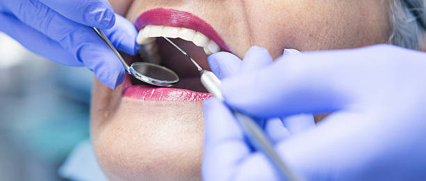 Best Emergency Dental Care for Abscessed Tooth in Ferdand, IN